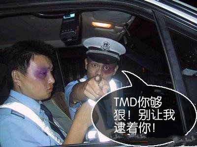 被打得黑眼圈：TMD你够狠！别让我逮着你！