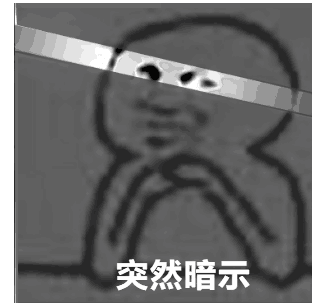 突然暗示